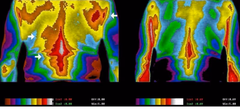 Thermal imaging showing inflammation reduction before and after grounding
